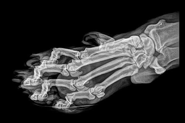 12. Чья лапа?