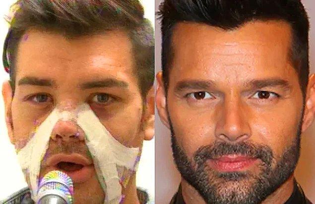 13. 4 kez burnundan 7 kez de yüzünden operasyon geçiren Fran Mariano, Ricky Martin'e benzemek için elinden geleni yapmış, başarılı da olmuş doğrusu.