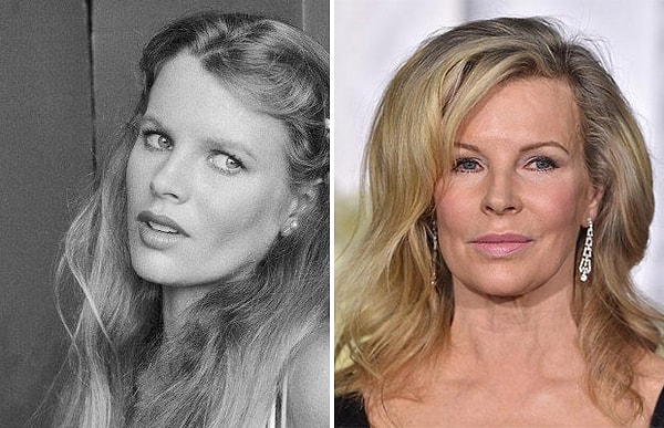 2. А вот у Ким Бейсингер налицо увлечение пластикой.