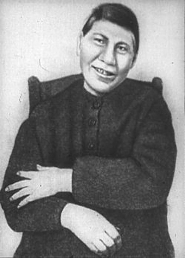 5. "Умственная отсталость" в медицине называется...