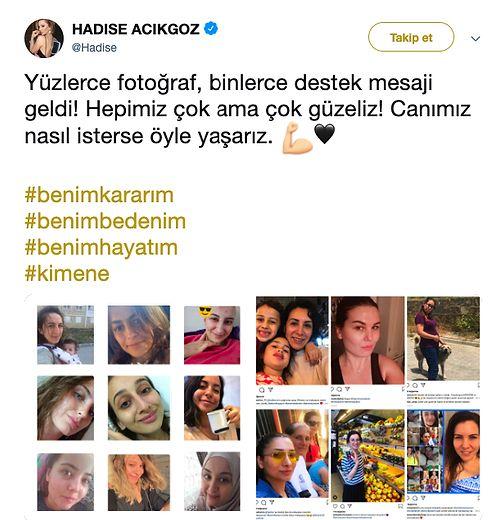 Binlerce Dayanak Bildirisi Geldi! Cengiz Semercioğlu'nun Hadise'nin Makyajsız Olmasını Eleştirmesine Ünlüler Sessiz Kalmadı!