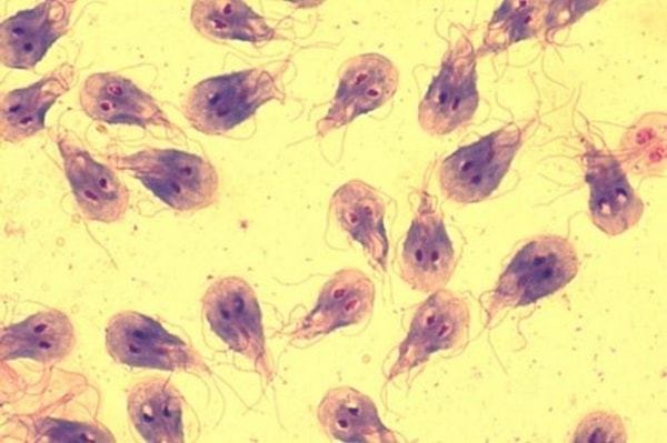 7. Какой орган поражается при лямблиозе?