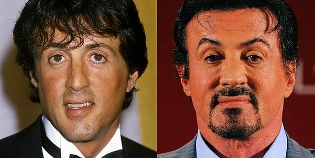 5. Sylvester Stallone'ın kaşları yaptırdığı botoksun habercisi gibi.