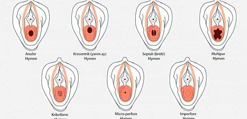 Vajinanin Guzel Gorunmesi Nasil Olur Turleri Ve Cesitleri