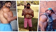 Hayatı Pahasına Devasa Kaslarına Hala Yağ Enjekte Eden Vücut Geliştirici