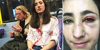 Londra'da Bir Otobüste Dört Magandanın Tacizine ve Saldırısına Maruz Kalarak Darp Edilen Lezbiyen Çift