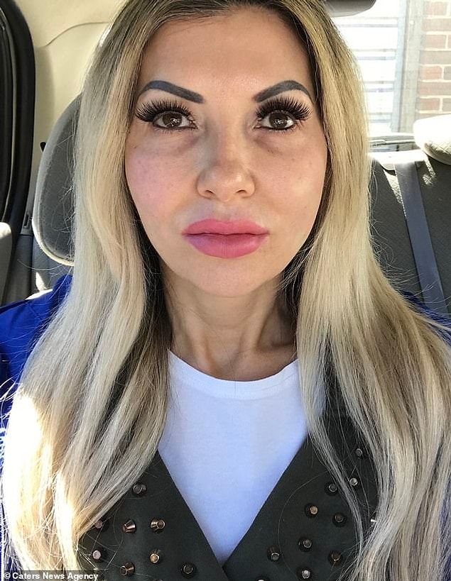 Sadece bu yıl 6 ameliyat olmasına rağmen Rachel, 50. doğum gününe kadar bir şeyler daha planladığını söyledi.