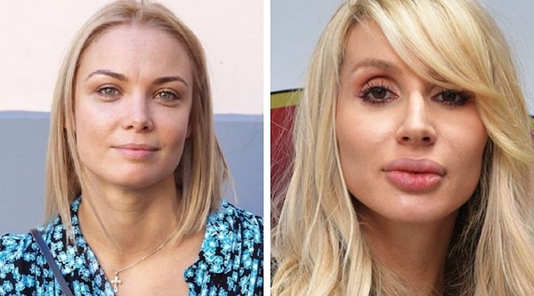 20. Ольга Арнтгольц и Светлана Лобода (36 лет)