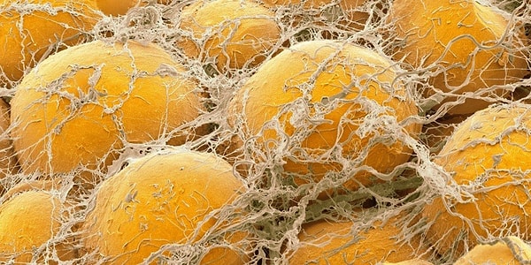 6. Что такое бурый жир?