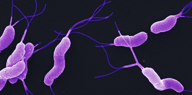 14. Mide kanseri ve H.Pylori enfeksiyonu