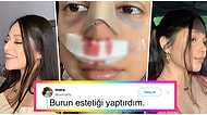 Göründüğü Kadar Kolay Değilmiş! Burun Estetiği Yaptırdıktan Sonra Bambaşka Birine Dönüşen İnsanlar