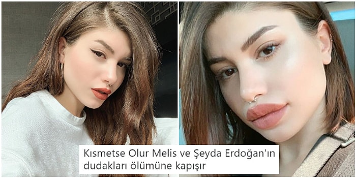 Ünlü YouTuber Şeyda Erdoğan, Dudak Dolgusu mu Filtre mi Olduğu Anlaşılamayan Yeni Görüntüsüyle Herkesi Şoka Uğrattı