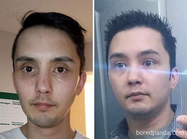 32. Бросил пить и набрал 9 кг.