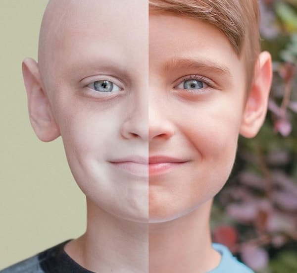 1. Тогда и сейчас: мальчик, который победил рак