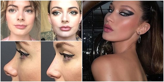 Estetik Operasyon Modasının Güzellik Anlayışımızı Nasıl Radikal Şekilde Değiştirdiğini Gösteren Örnekler