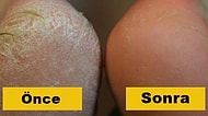 Topuk Çatlağına Meydan Okuyup Pürüzsüz Ayaklara Sahip Olmanızı Sağlayacak 11 Ev Yapımı Karışım