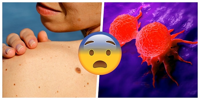 'Acaba Kanser miyim?' Korkusu Taşıyanların İçine Serin Sular Serpecek 7 Ferahlatıcı Gerçek