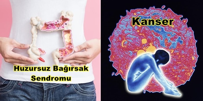 Hastalığınızın İsmi Farklı Olabilir mi? Doktorların Yanlış Tanı Koyma Olasılığı Yüksek Olan Hastalıklar