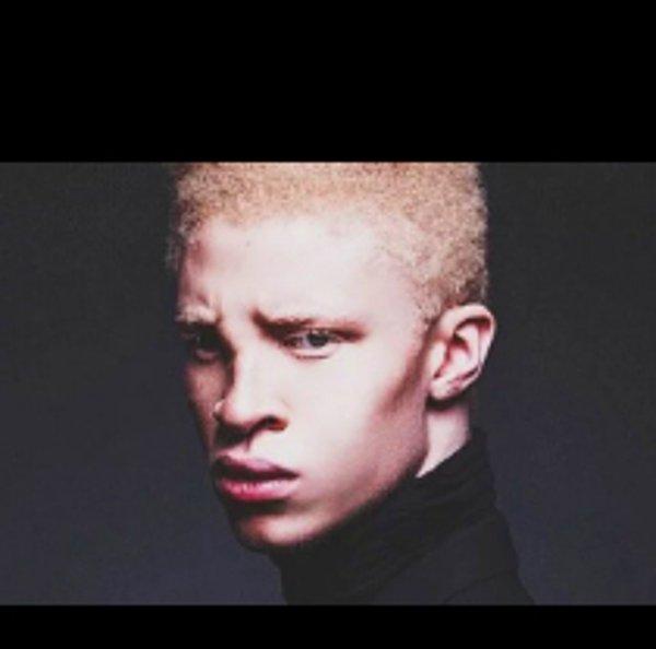 albino zencü