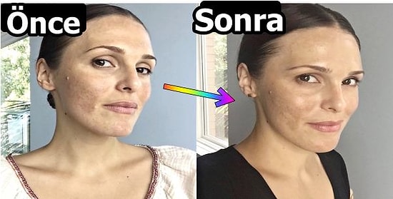 Cildinizin Çok Daha Canlı ve Parlak Görünmesini Sağlamak İçin Mutlaka Tüketmeniz Gereken Besinler