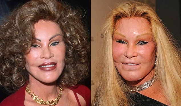 BONUS 2: Jocelyn Wildenstein