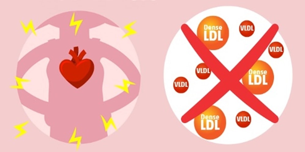 Kalp Hastalıklarına Davetiye Çıkaran Kötü Kolesterolü Düşürmek İçin Ne Yapmanız Gerektiğini Biliyor muydunuz?