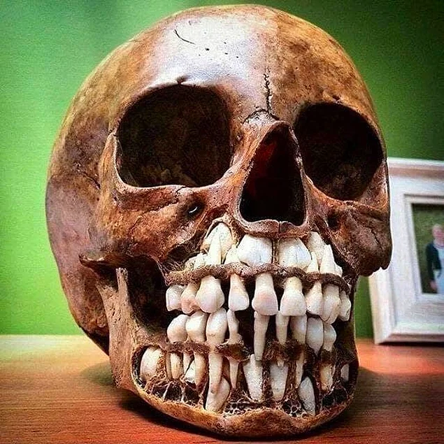 Süt dişleri, kafatasının içinde bu şekilde görünür.