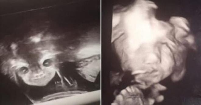 Ce-eee! Ultrason Görüntüsünde Annesini Korkutmaya Karar Veren Bebek ile Tanışın