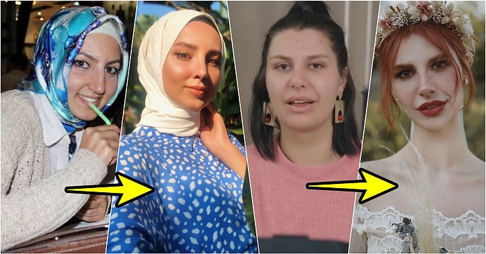 Plastik Cerrahinin Nimetlerinden Sonuna Kadar Yararlanıp Bambaşka Bir Yüze Sahip Olan 20 Kişi