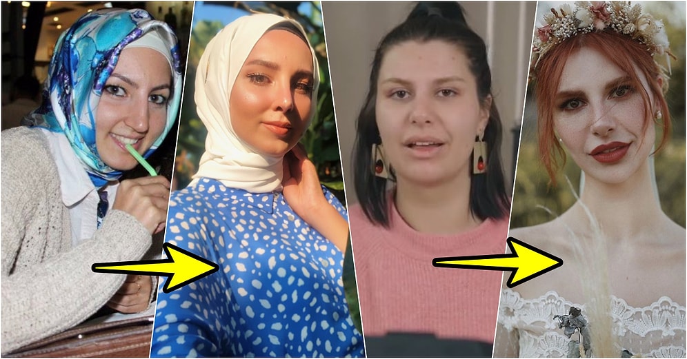 Plastik Cerrahinin Nimetlerinden Sonuna Kadar Yararlanıp Bambaşka Bir Yüze Sahip Olan 20 Kişi