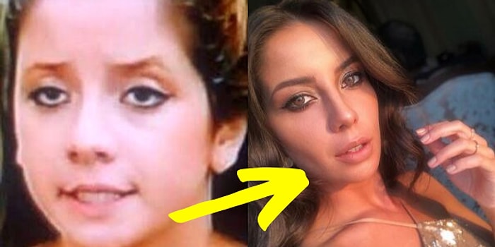 Melis Tüzüngüç'ün İnsana "Yok Artık!" Dedirten Yıllar İçindeki Değişimini Görünce Küçük Dilinizi Yutacaksınız!