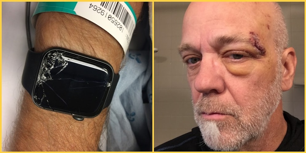 Para Tuzağı Olarak Gördüğümüz Akıllı Saatin Kafasını Kayaya Çarpıp Bayılan Adamın Hayatını Kurtarma Hikayesi!