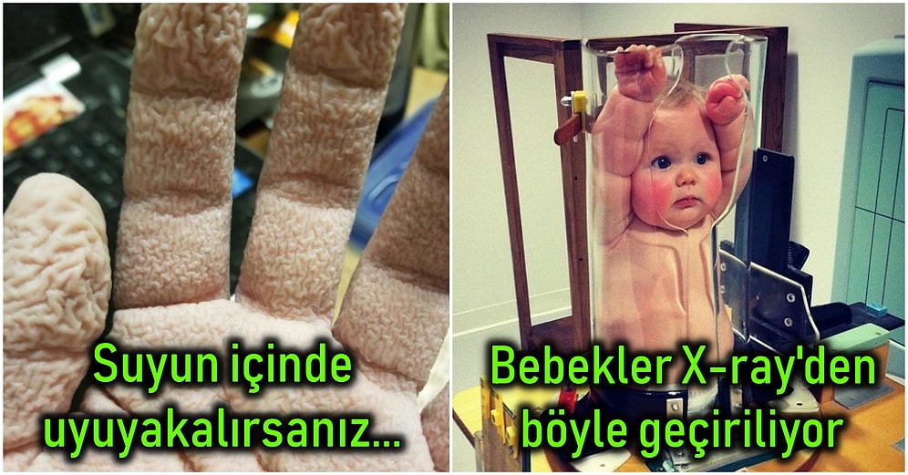 İnsan Vücudunun Tüm Evrendeki En İlginç Varlıklardan Biri Olduğunu Kanıtlayan 20 Şaşırtıcı Görsel!