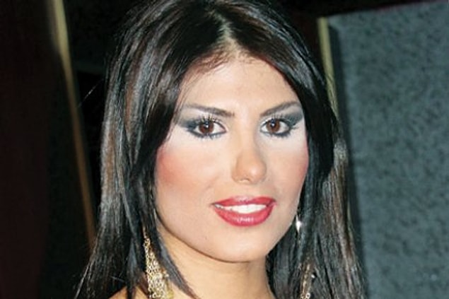 Yanak dolgusundan,