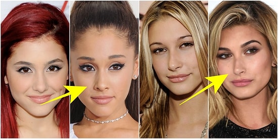 Hep Nasıl Yaptırıyorlar Diye Merak Ettiğiniz Göz Kapağı Estetiğinin Tüm Detaylarını Paylaşıyoruz!