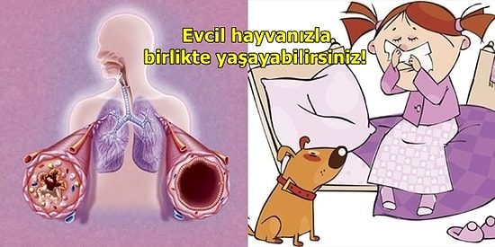 Astımla Yaşamaya Alışın! Ömür Boyu Süren Bu Hastalıkla Nasıl Baş Edebileceğinizi Biliyor muydunuz?