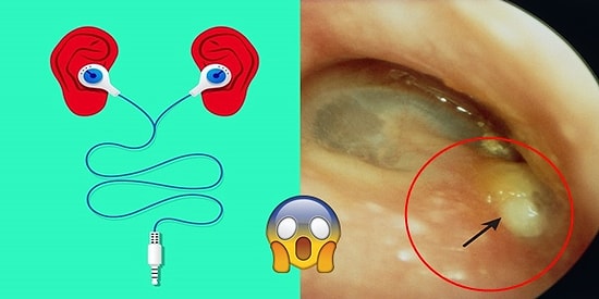 Kulaklık Kullanmanın Ölümle Bile Sonuçlanabilen Muhtemelen Hiç Düşünmediğiniz Zararları
