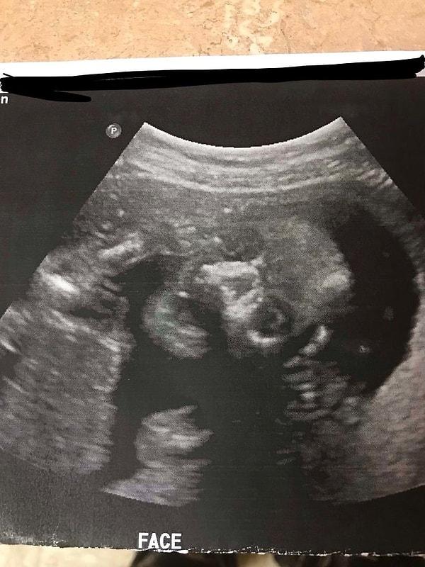 22. "Bebeğimizin ultrason fotoğrafı kocamı çok korkutuyormuş."