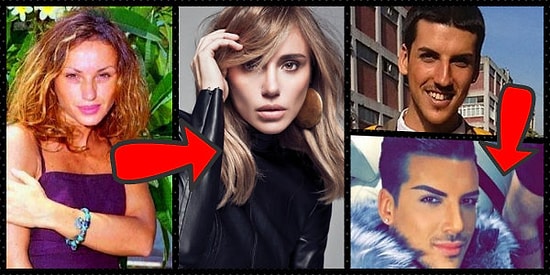 Estetik Ameliyat Rezil de Eder Vezir de! İşte Estetik Operasyonun Harika Sonuçlar Verdiği 20 Ünlü İsim