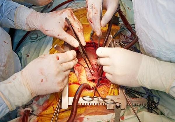 Gerçekleşen operasyonda kalp ölümü gerçekleşen hastadan alınan kalp, tekrar çalıştırılarak başka bir hastaya naklediliyor.