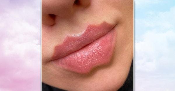 Şeytan veya ahtapot dudakları denilen bu şekilde dudağa tıpkı doğal dudakların üst ısmındaki gibi köşeler ekleniyor.