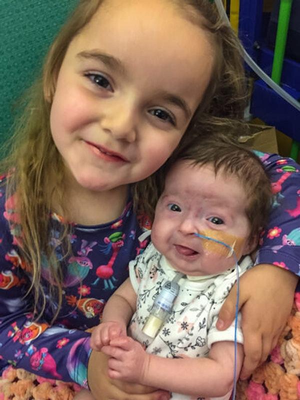 2 Şubat 2017 günü doğan Isla, 1 ay boyunca hastanede kaldıktan sonra evine gidebildi fakat bir gün rengi maviye döndü ve tekrar hastaneye götürüldü.