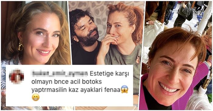 Ceyda Düvenci'den Göz Kenarlarındaki Kırışıklıklara Botoks Yaptırmasını Söyleyen Takipçisine Hayat Dersi Gibi Cevap