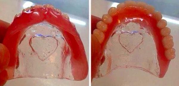 5. Sevgilin sana doğum gününde şöyle kalpli, hem de en kırmızı diş etlisinden bir diş protezi hediye etti diyelim. Tepkin ne olurdu?