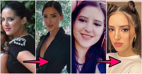 Son Dönemin En Çok Konuşulan YouTuberlarından Ala Tokel'in İnanması Güç Değişimi Karşısında Afallayacağınız Kesin