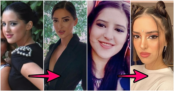Son Dönemin En Çok Konuşulan YouTuberlarından Ala Tokel'in İnanması Güç Değişimi Karşısında Afallayacağınız Kesin
