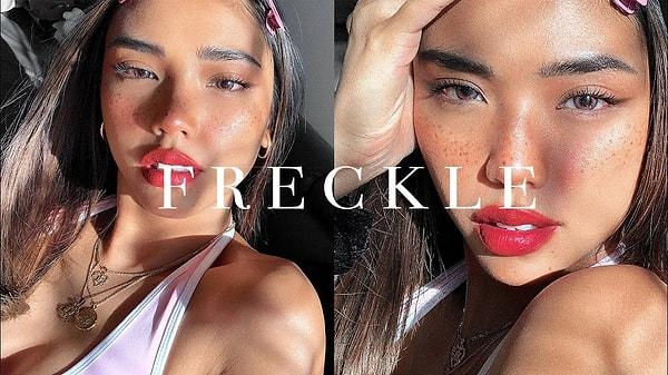 10. Freckle