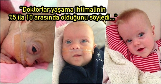 Doğuma 16 Hafta Kala Doğan Prematüre Edie Bebeğin Mucizevi Bir Şekilde Hayata Sıkı Sıkıya Tutunma Hikayesi