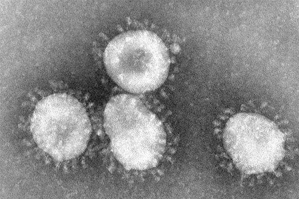 SARS (Severe Acute Respiratory Syndrome) virüsü ilk olarak 2002'nin Kasım ayında Hong Kong'da görülmüş olan bir virüstür.