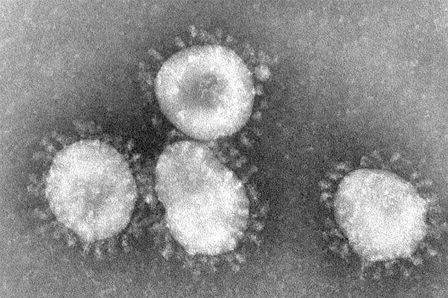 SARS (Severe Acute Respiratory Syndrome) virüsü ilk olarak 2002'nin Kasım ayında Hong Kong'da görülmüş olan bir virüstür.